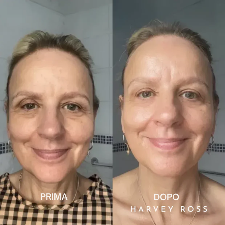 Harvey Ross - Lifting Instantaneo Facile