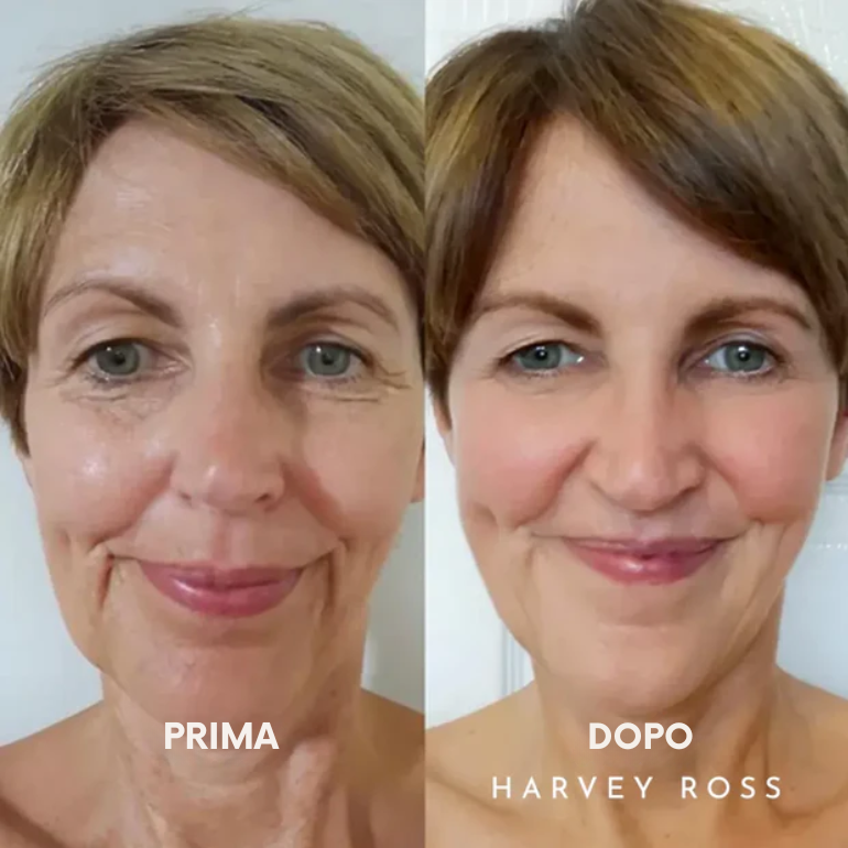 Harvey Ross - Lifting Instantaneo Facile