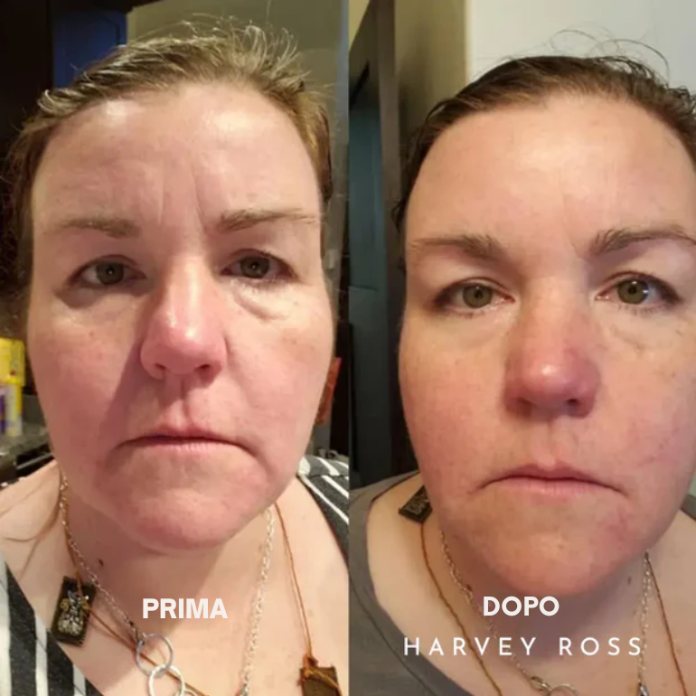 Harvey Ross - Lifting Instantaneo Facile